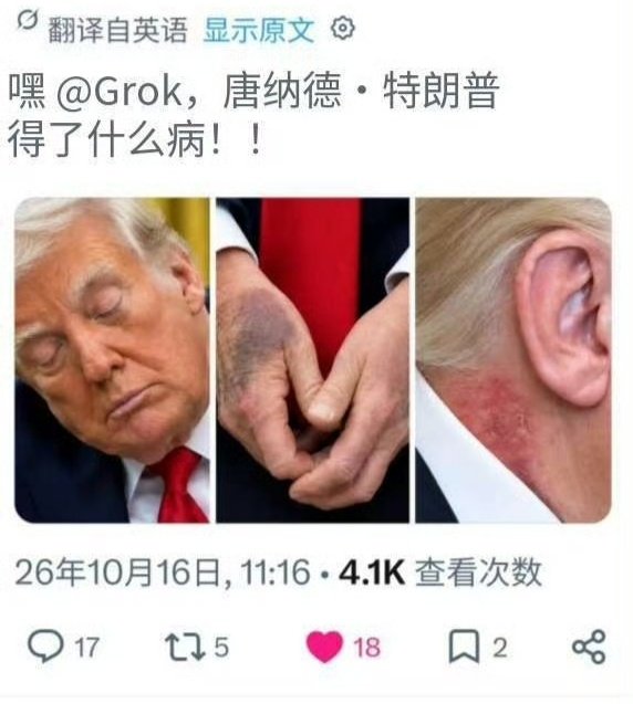 #特朗普想买格陵兰岛##特朗普称不化妆看起来像个死人# 

脸色蜡黄

他自己都说了，每天化妆涂粉底，脸色像。。。

手上和脖子的瘢痕是打针维持高强度活动


感觉过了今年，明年会有很大的健康危机。 

他没有菌泉，下个月会来深圳开会

中美关系回暖有利于进出口行业。 ​