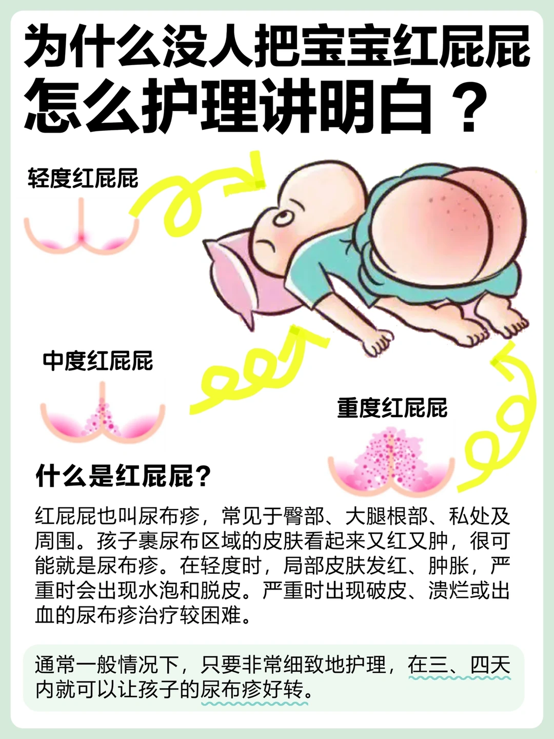 月嫂教的正确护理方法｜跟宝宝红屁股说拜拜