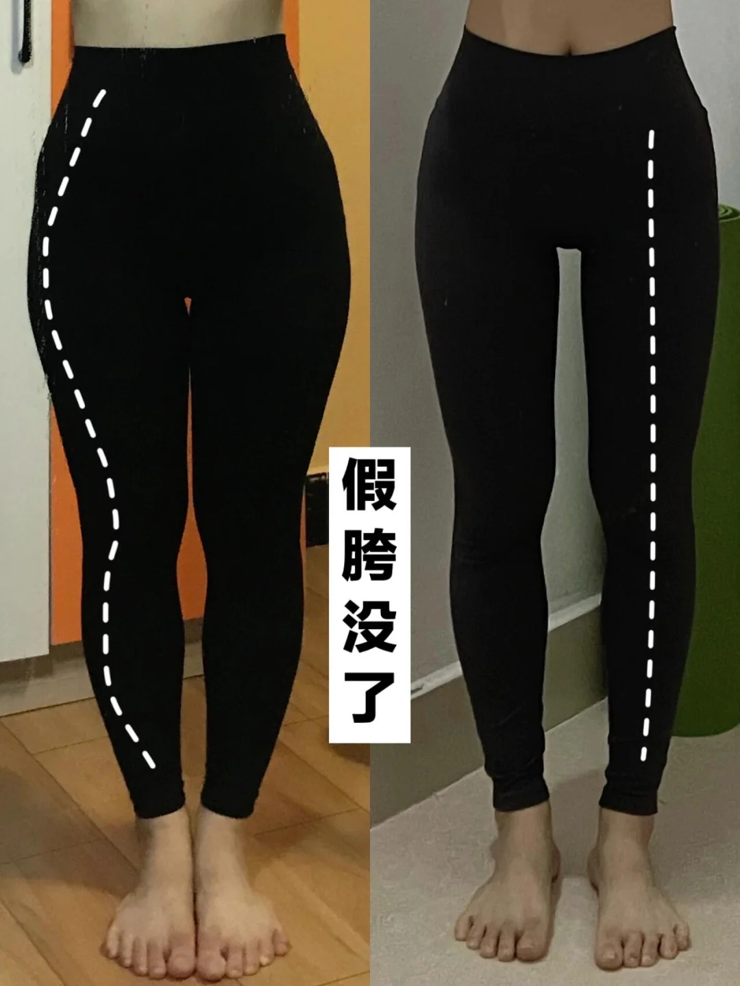 超强有效改善假胯款💪🏻瘦大腿内侧外侧