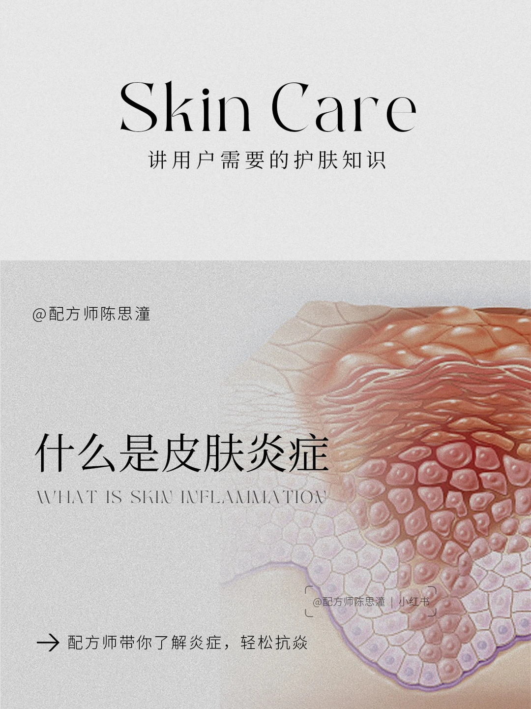 护肤知识｜什么是皮肤炎症？如何有效抗炎