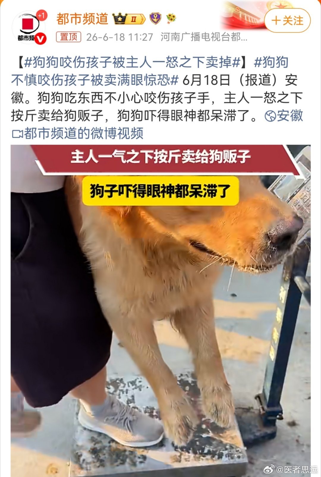 又要开始干活了？什么叫不慎呢？如果这个狗没有打狂犬疫苗，被咬的孩子...