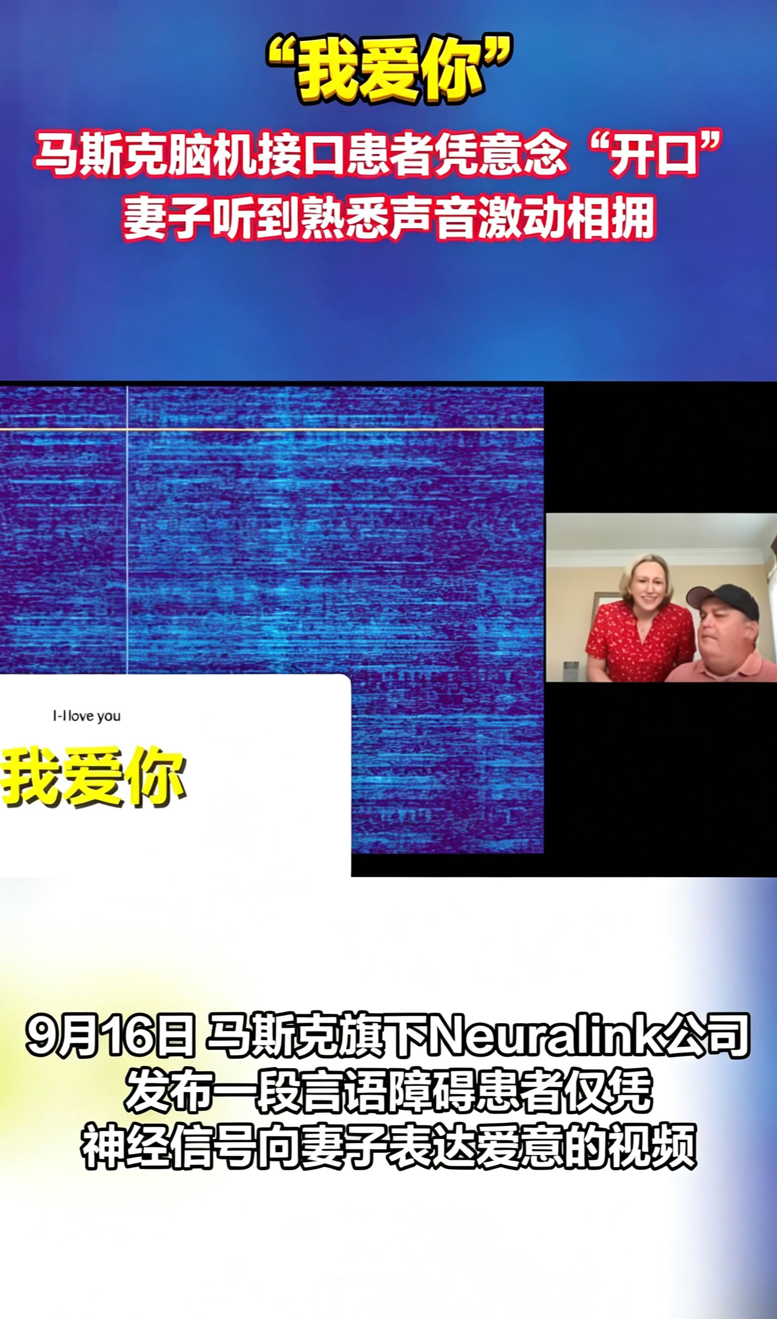 脑机接口患者凭意念说出我爱你