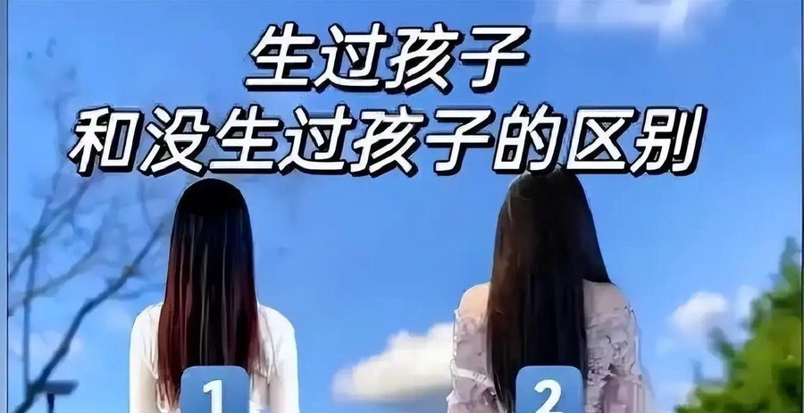 痞幼没生过孩子，却做了“妈妈臀”吸脂手术。术后14天，体重从88斤涨到105斤，涨了17斤。她说术后疼得没办法正常坐，没办法正常躺。
这事据新民晚报2026年4月17日报道。痞幼在直播里自己讲的，臀部上方两侧脂肪堆积，从后面看不好看，为了上镜去做了手术。术后住院只住了一天，但14天过去了，臀部还是肿
