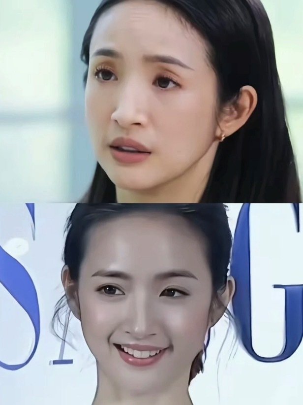 她的眼睛是怎么了？ ​