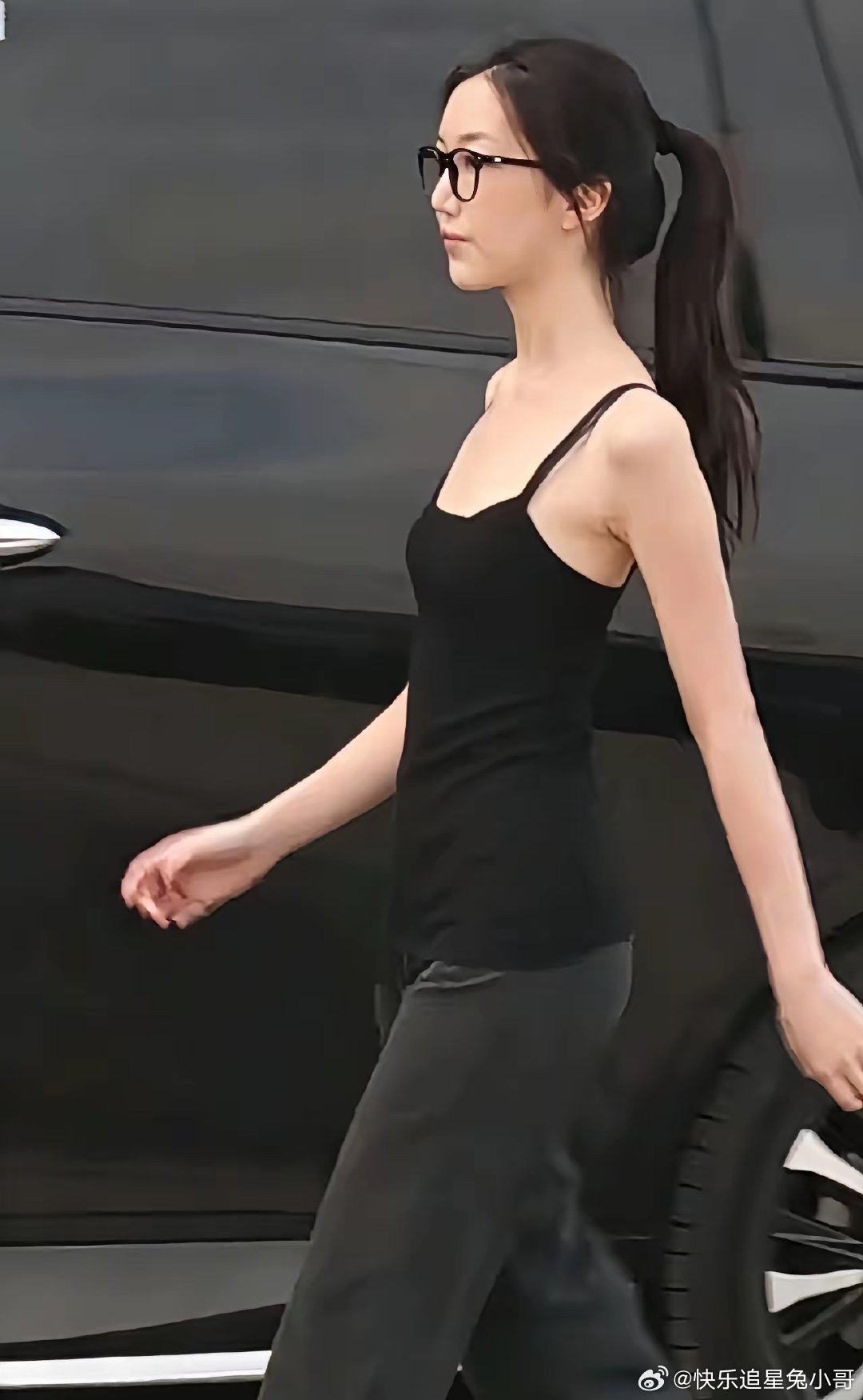 李亚鹏这么有钱，李嫣的嘴巴还是修复的不是很好，上嘴唇还是有点缺陷，不过比小时候好看很多了。 ​