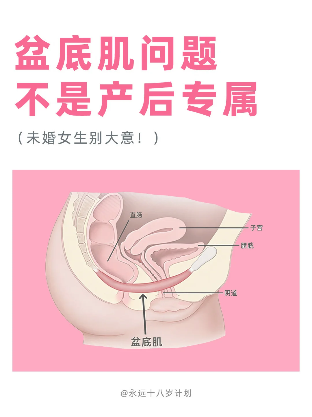 永远十八岁  盆底肌问题不是产后专属