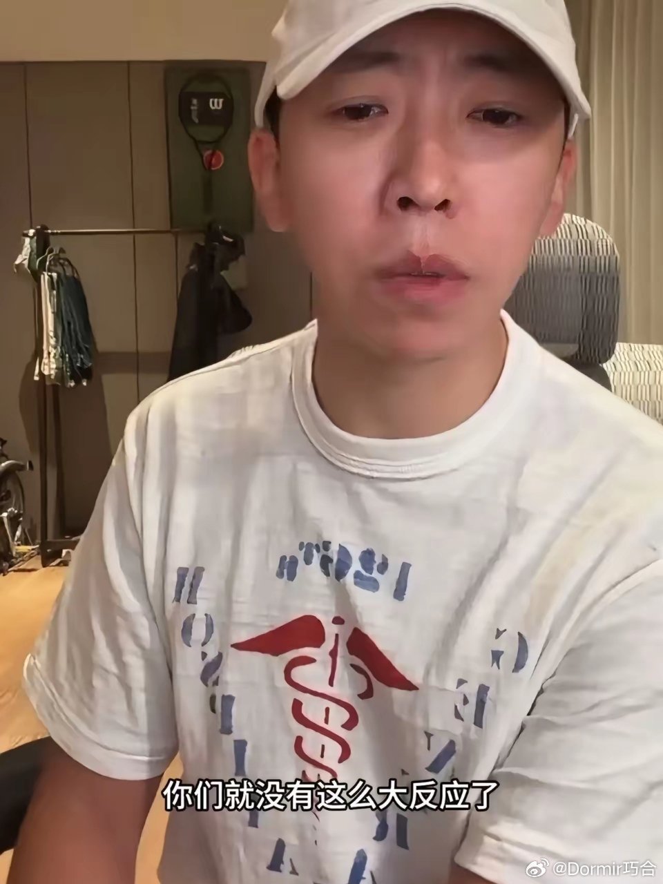 留几手力挺张家齐妈妈！

直播时提到张家齐母亲，他情绪激动的说：“母亲花女儿的钱怎么了？有什么问题吗？如果她花的是儿子的钱，你们会有这么大反应吗？你们就没这么大反应了，你们就共情女儿了，但你有没有想过，她妈妈也是女性啊，你们也应该共情。”

这番话惹全网反感，网友怒斥他强行扯男女对立 ​