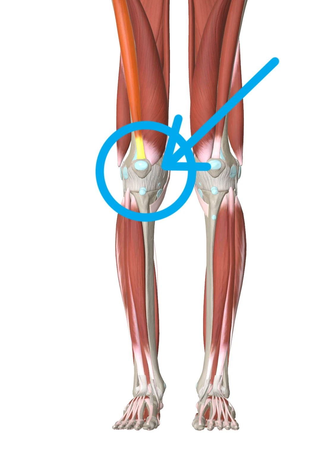 从解剖结构上看膝关节弯曲时的疼痛，于髌骨的滑动障碍有关。