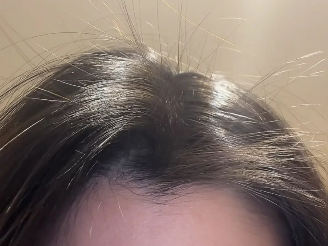 强推一个神奇的发际线聚拢剂