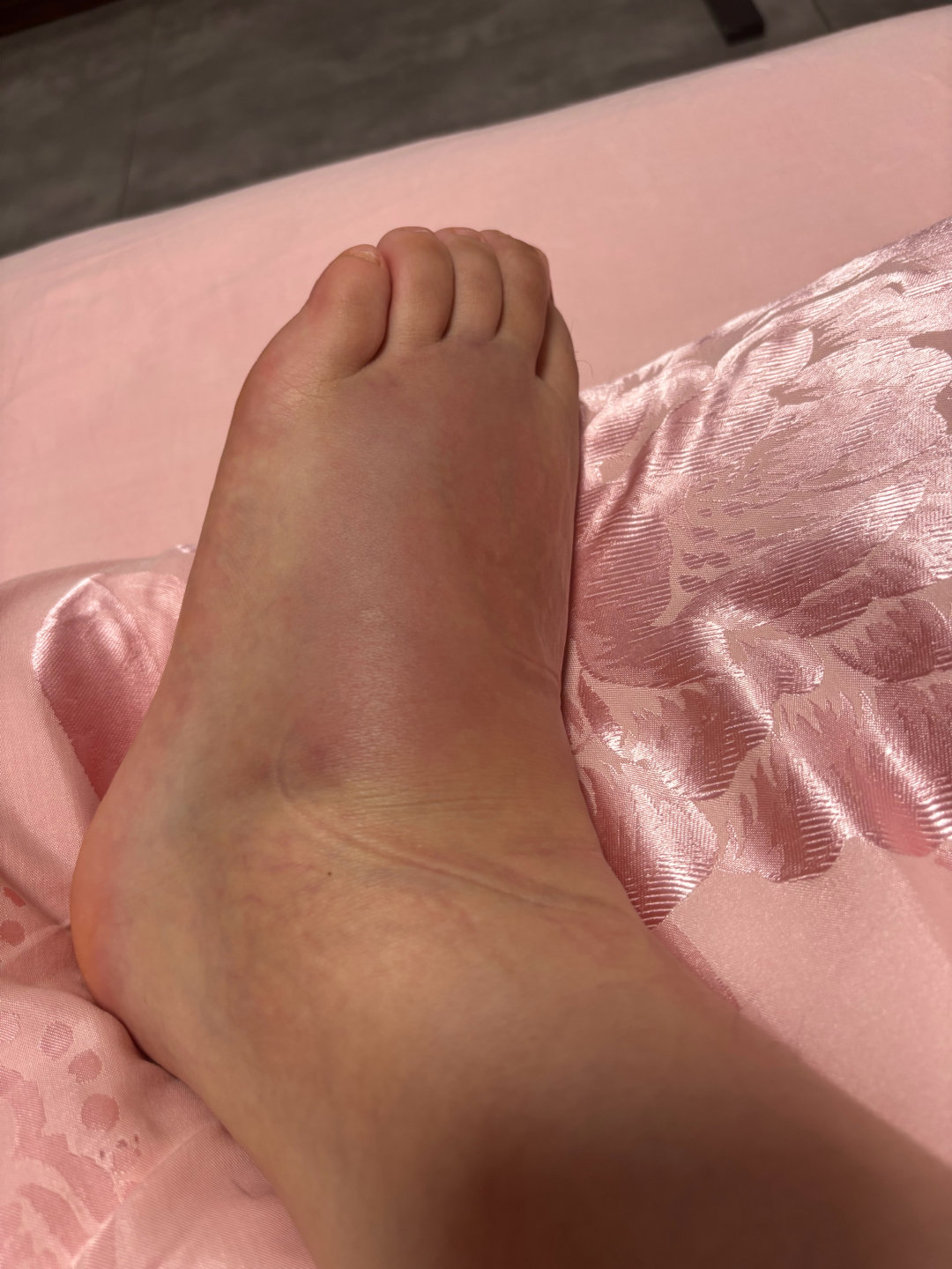 感恩美团京东
闪送真的非常快
养了一周了
继续保持制动 ​