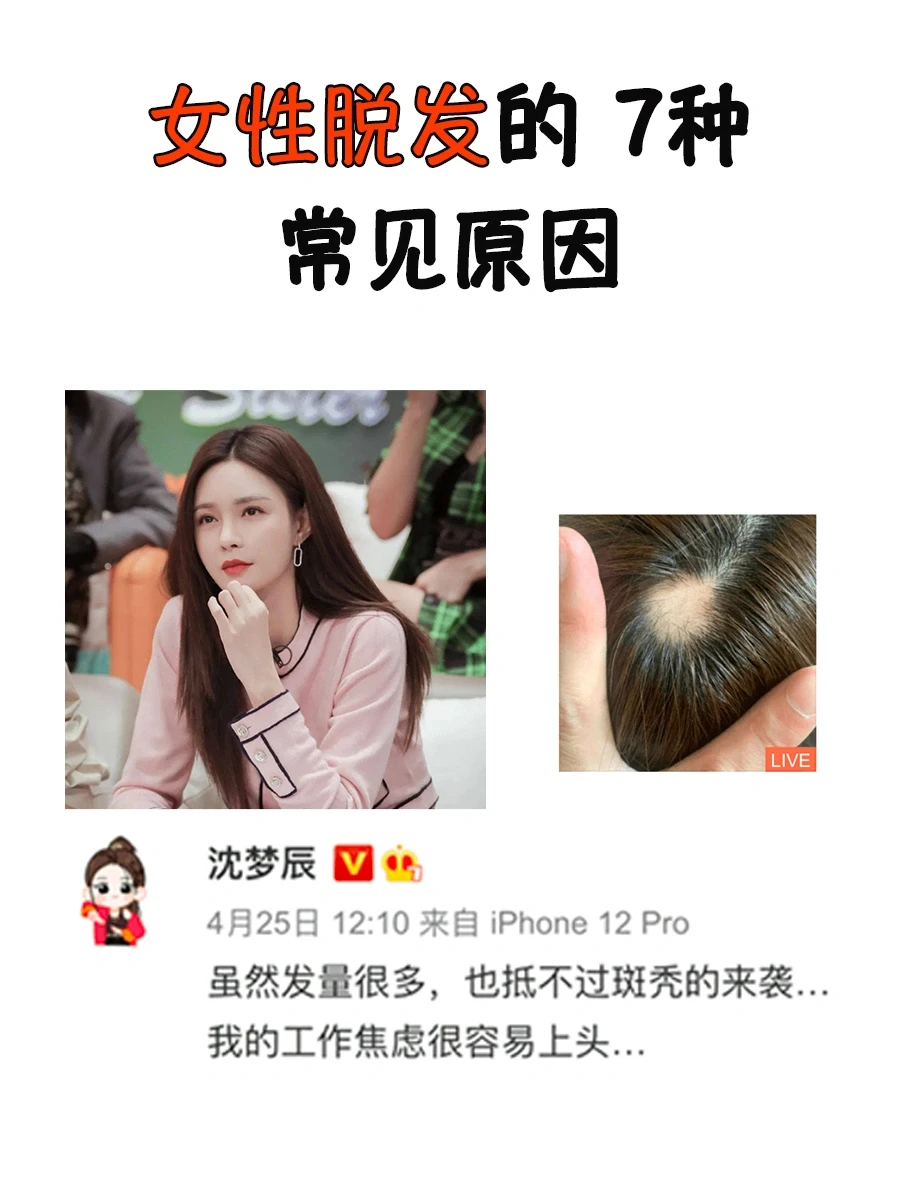 女性脱发的7种常见原因，很多人不知道🚫