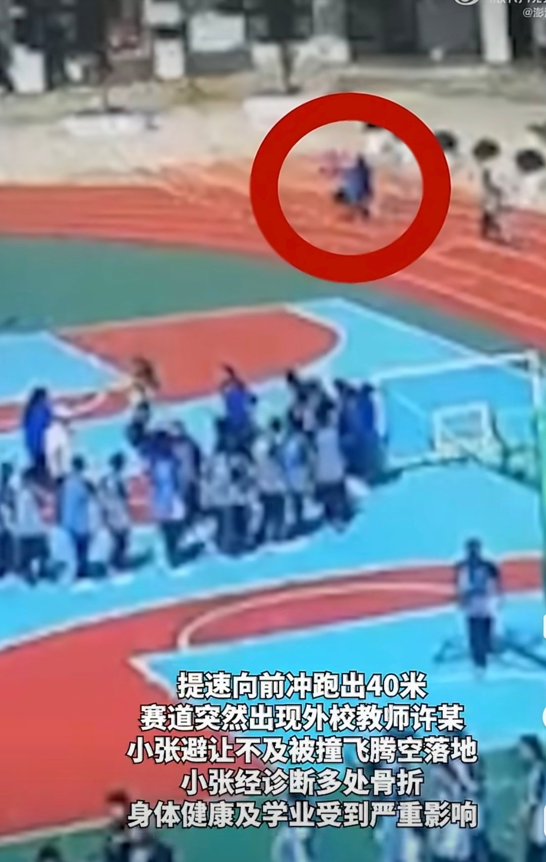 #老师横穿跑道致学生被撞骨折赔3万#老师不在跑道上被学生撞，估计要被在公路上被车撞了，一点路不看的。 ​