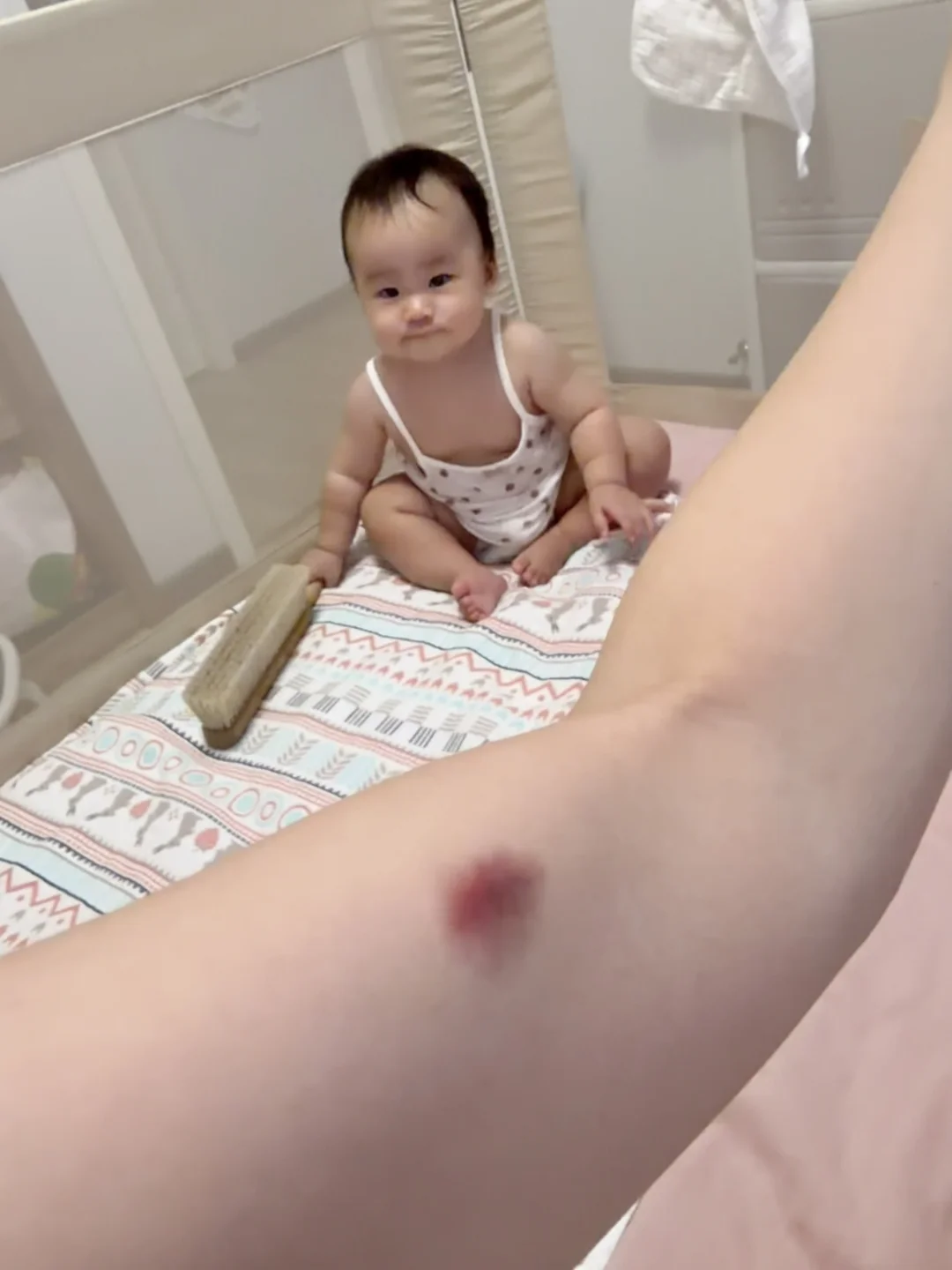 不亚于被鳖咬了一口