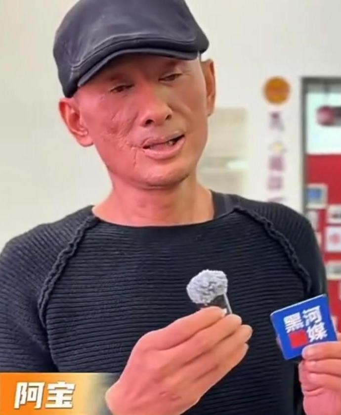 久未露面的歌手阿宝近日在黑龙江黑河的群众文艺大赛上现身，却因面部变化成为焦点。57岁的他嘴角有一道显眼印记，面部纹路僵硬，引发网友对“烧伤说”和“医美说”的广泛猜测。
当晚他演唱《赶牲灵》，高音依旧稳定有力。尽管沉寂多年，他并未放弃音乐——近年回到山西大同，自掏腰包筹建民歌传习所，深入乡村录制濒危民