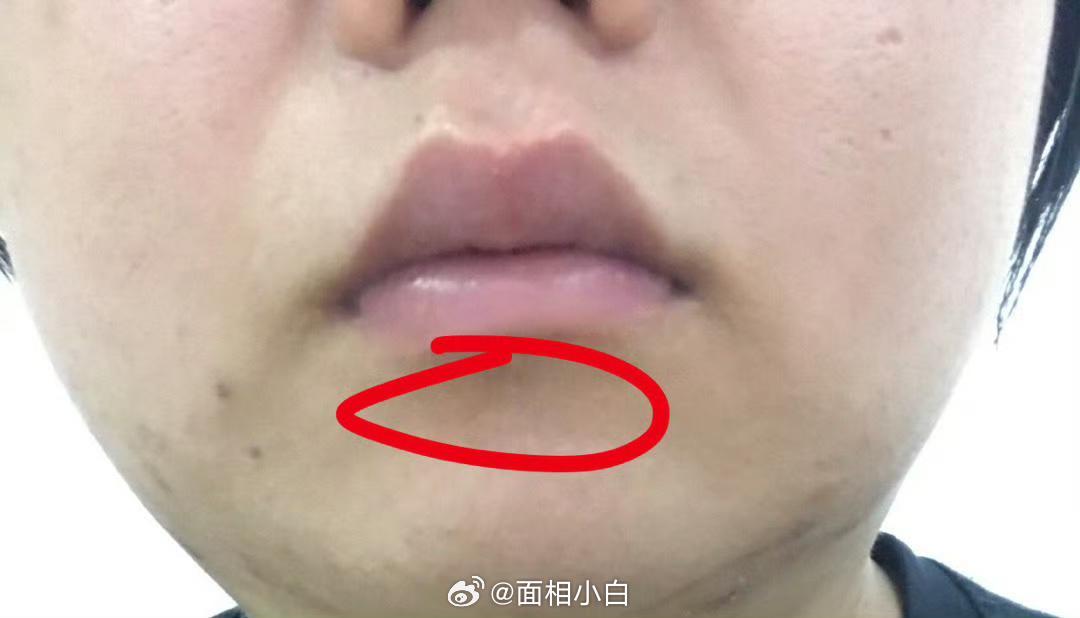 下巴下方长期气色青暗的人，一般都是所住房屋室内阳光不足，阴气重，比如宅男宅女不喜欢出门的就容易这样；或家中常年有病人。 ​​​