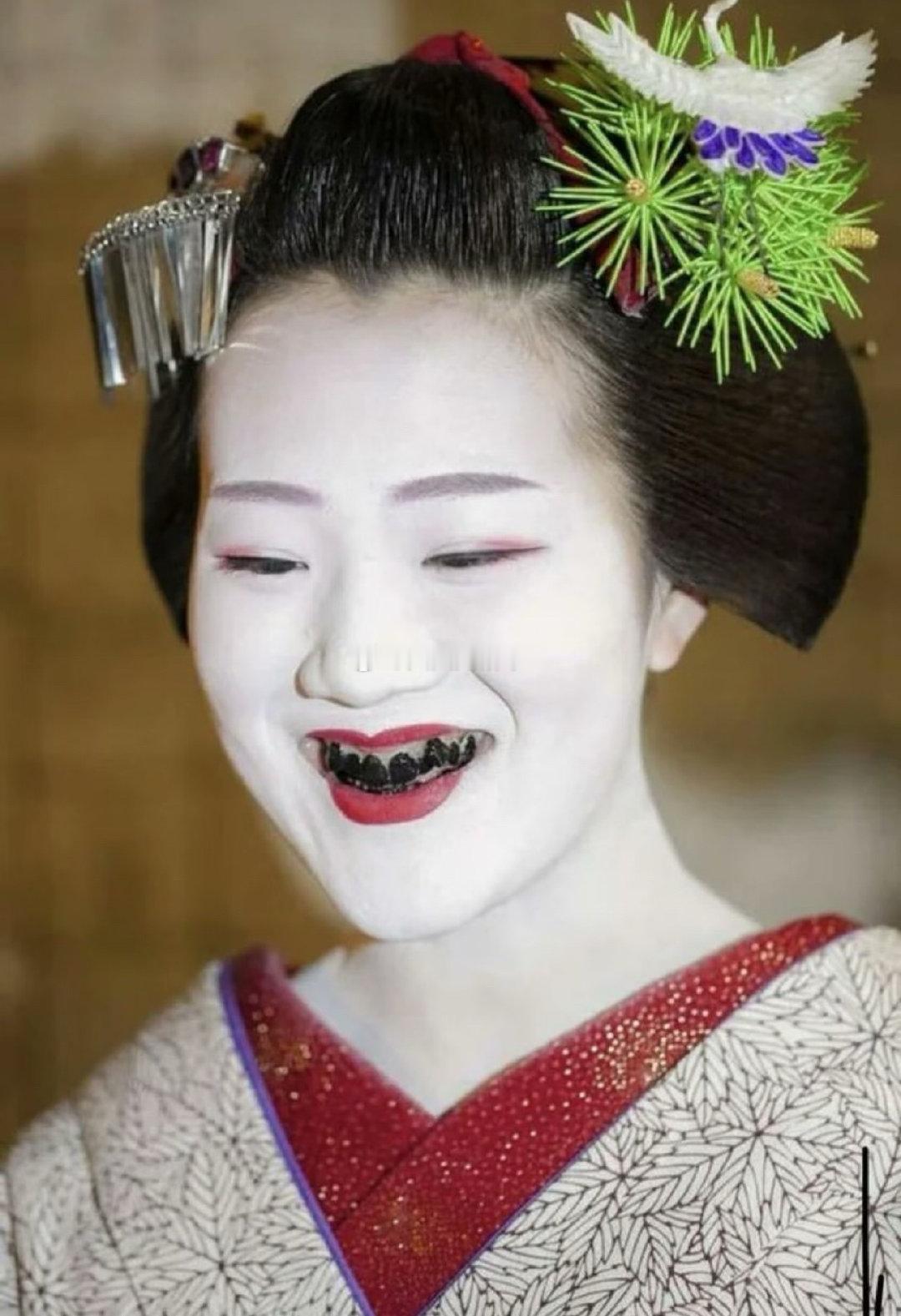 日本梅毒病例十余年暴增超12倍，社会原子化的“三个一”成为理解这场公共卫生危机的关键切口——从独食、独居到夜间社交萎缩，这种孤独的生存状态正在让部分人将身体当作换取即时慰藉的“最后货币”。  一、“三