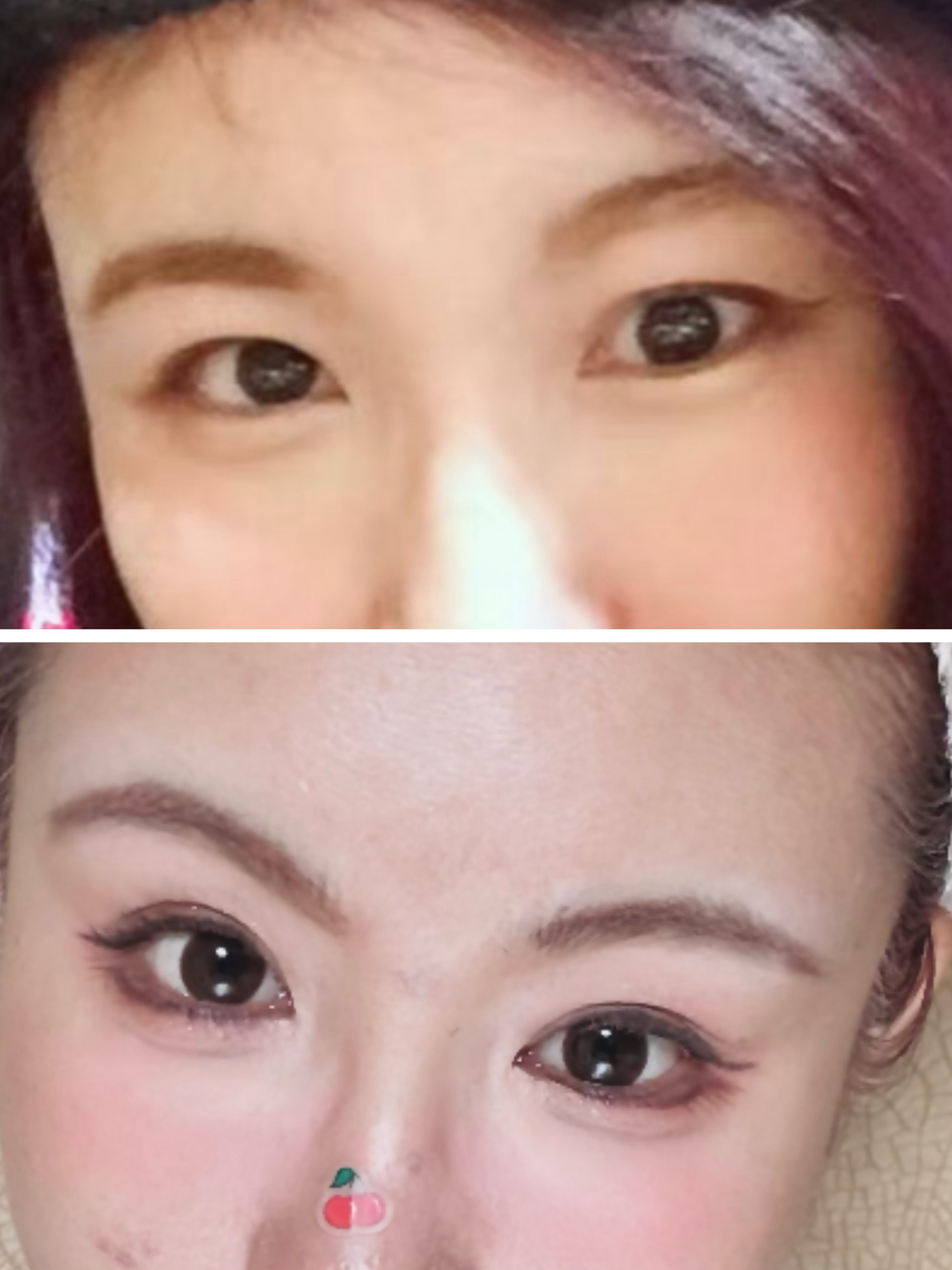 最近那个韩国啥“尸皮针”的新闻大家看到了吧不知道材料是不是真的用那种东西做的，很吓人我对DO脸特别慎重首先说说为啥我不纹眉首先我感觉眉型流行来回变之前韩式大平眉大家都知道吧，我之前也是画平一点，虽然画的不咋好另外审美一直在变，说不定说阵子喜欢别的眉型我本人脸是一点都没动的，你看上下半截，感觉我五官立体度都变了，我昨天还刷到一个打玻尿酸的，打了好几年去照核磁共振，脸上都是残留的玻尿酸，而且已经移位。完全取出是不可能的；所以为啥很多明星看着馒化，就是玻尿酸残留吸水，感觉人特别肿。我觉得永久半永久的项目，纹脸上或者打脸里，都需要慎重，因为不知道几年后咋样。 韩国尸皮针使用者发声