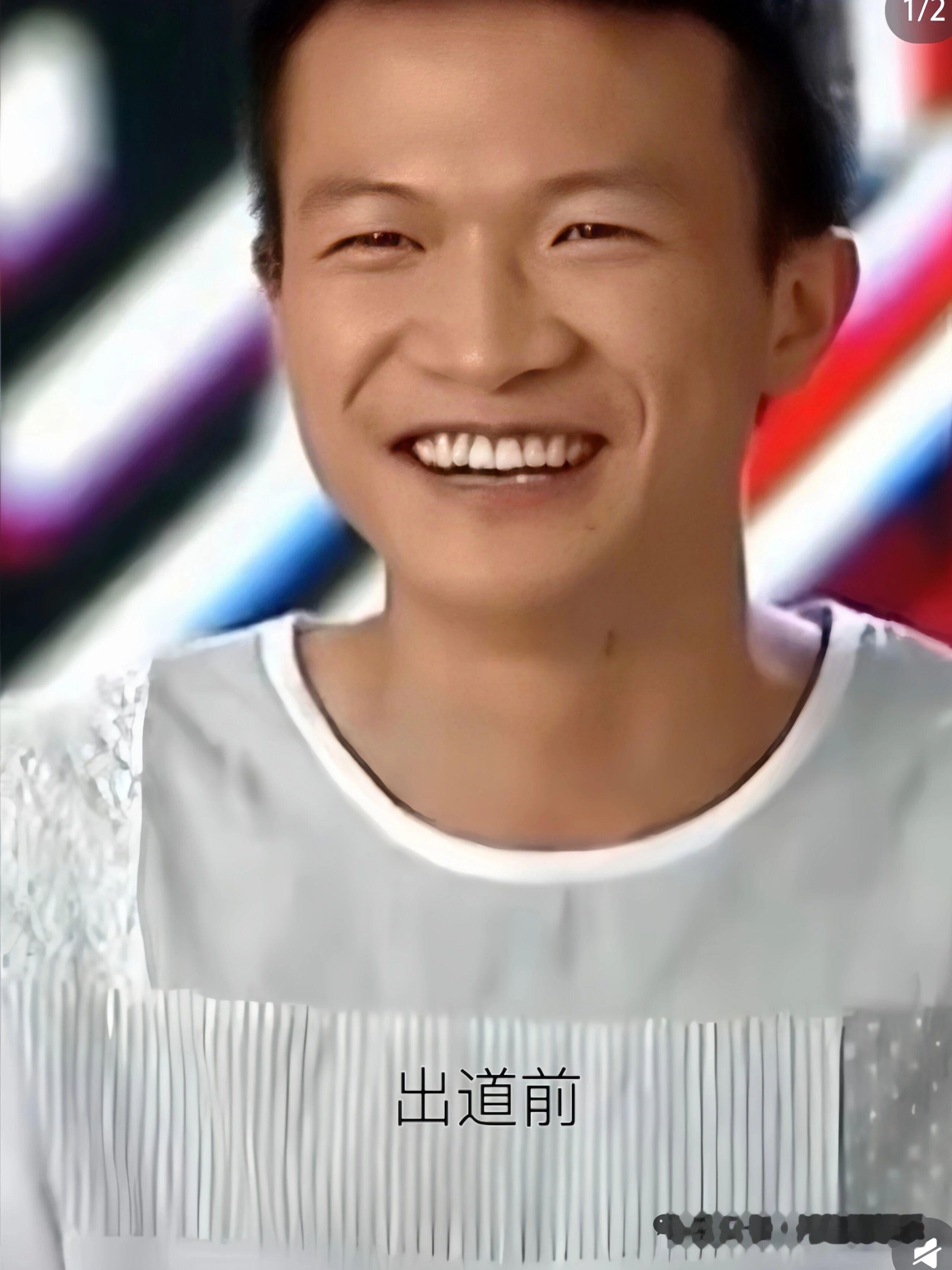 周深出道后整容了吗？
有人说周深出道前皮肤黑，现在皮肤白，还说他割了双眼皮就认为他整容了。周深2014年，参加《中国好声音》时，皮肤确实黑，其实那不是他真正的肤色，当时化妆师为了制造“素人形象与天籁嗓音”的强烈反差，特意用了比他肤色深的粉底来涂黑他的脸，他那时经常户外活动，皮肤晒的黑一些也很正常。不
