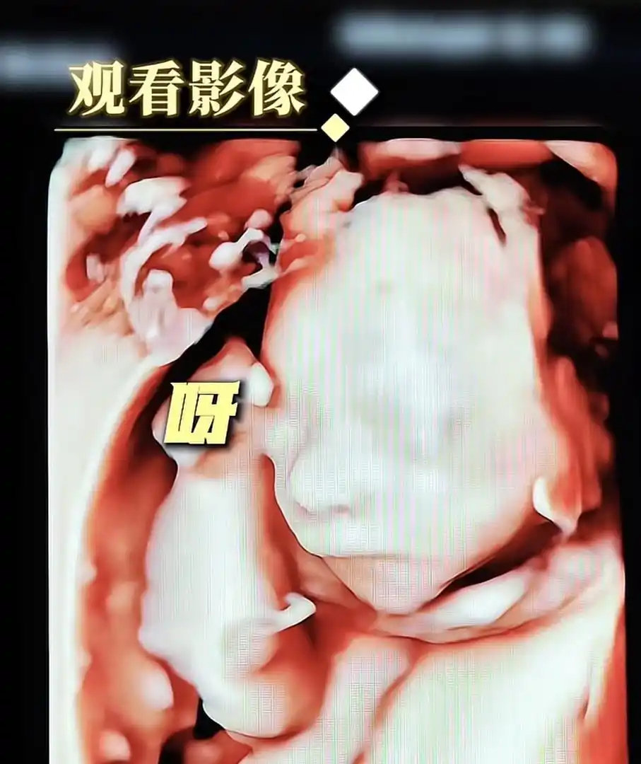 任重陪妻子做四维！41岁孙骁骁素颜似20，二宝高鼻梁尖下巴像妈妈 ​