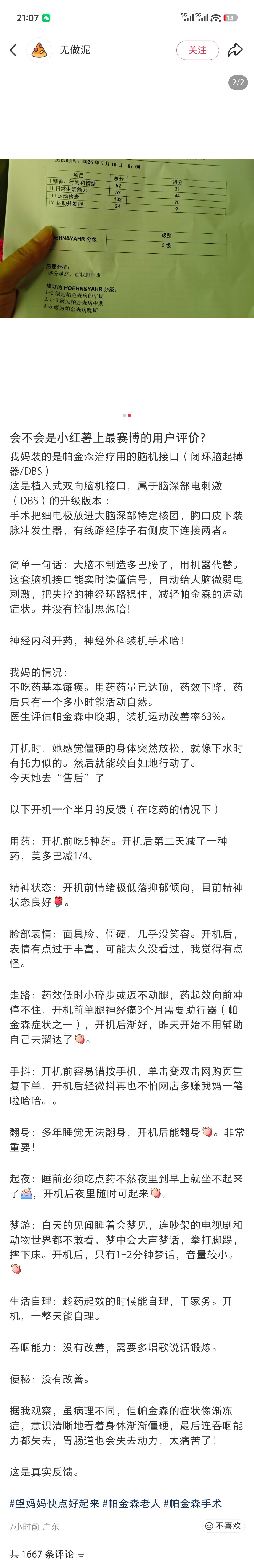网友发的帕金森综合征病人的脑机接口使用体验。 ​