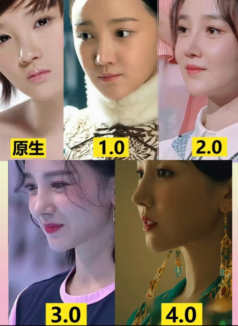 #陈小纭 整骨#一位曾在节目上大方承认为变美整骨十次的漂亮女人。
如今脸部僵硬到大家觉得判若两人，在其中我们不得不承认她对美的追求是十分执着的，另一方面也能看出上镜需求对演员是非常严格的。
女人至死是少年，爱美不耽误她的生活，她现在也很美。 ​