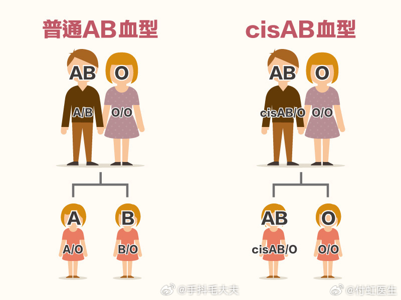 #爸爸AB型妈妈A型女儿O型##健闻登顶计划# 课本ABO血型遗传规律：AB型父母只能传给孩子A或B基因，无法传递O基因。因此AB型与A型结合，子女一般为A、B或AB型，通常不会出现O型。
 但罕见CisAB亚型会打破这个规律，发生率约十七万分之一至五十八万分之一。这是遗传学上已知的特殊情况，别直接猜测是抱错或 ​