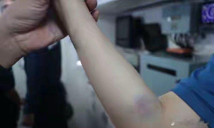 铁证实拍曝光！仁爱礁菲方持棍桨暴力袭扰，中方海警执勤人员受伤7月21日...