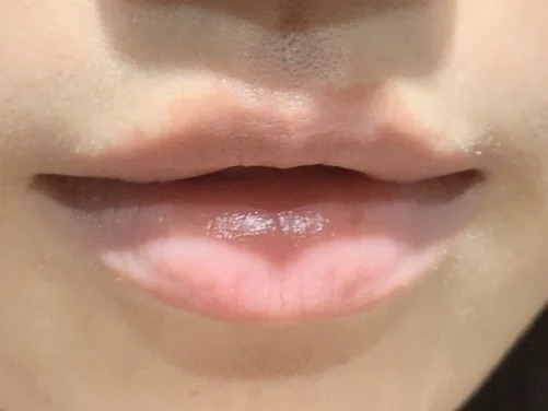 爱撕嘴皮的都去oliveyoung买这个！！！！！！！！！