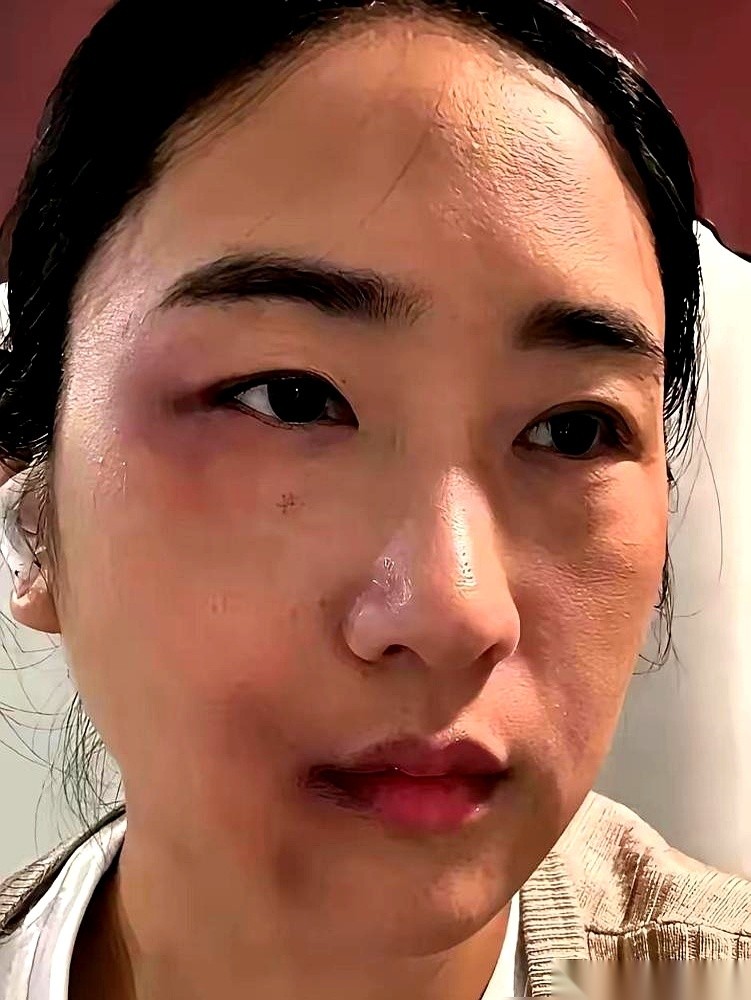 怀孕36周，肚子已经大到弯不下腰，后腰上却结结实实挨了丈夫狠踹的一脚。
没有掀翻桌子，没有坐地痛哭，据媒体报道，这位河南准妈妈在稳住身形后的第一反应，是拿手机留证、立刻报警、直奔相关部门申请人身安全保护令。
换作常人，很多人第一反应往往是懵在原地，脑子里全是“孩子快生了”、“家丑别外扬”、“他认个错