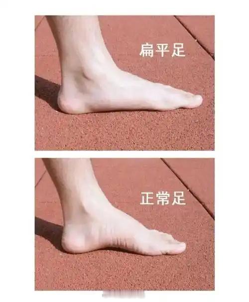 古话讲“脚凹能容龟，一生都富贵”。脚底越凹、足弓越高越好，精力异于常人，主富贵长寿；而扁平足的人不能走太长的路，很容易累，事业根基不稳定，易受人欺压。 ​​​