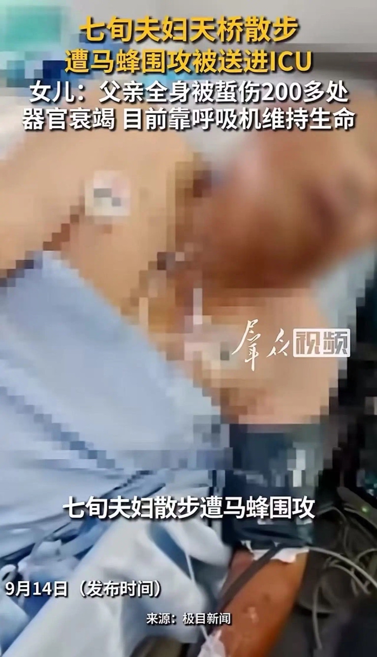 “谁来担责？”河南汝州，70多岁大爷牵着老伴出门遛弯，经过人行天桥时，突然遭马蜂群围攻，双双被送进ICU！女儿：“父亲全身被蜇伤200多处，各个器官已基本衰竭，两人尚未脱离生命危险，没有一个管理部门站出来承担责任！”

9月11日上午，汝州洗耳河景观桥。75岁的高大爷牵着老伴的手慢慢走，桥底下突然炸