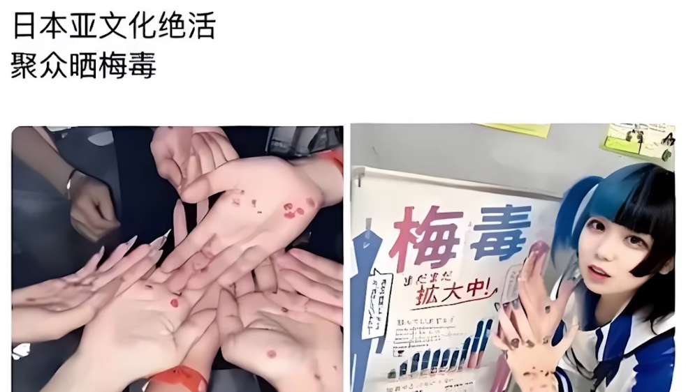日本公共卫生彻底翻车，梅毒感染人数疯狂暴涨，直接创下多年新高。更要命的是，治疗梅毒的独家救命药被美国突然断供，日本陷入无药可用的绝境，关键时刻，只有中国能稳定供货，成了日本的唯一救星。
 
很多人都觉得日本医疗体系很完善，公共卫生管控到位，传染病基本掀不起风浪。可现实狠狠打脸，近些年日本梅毒疫情一路