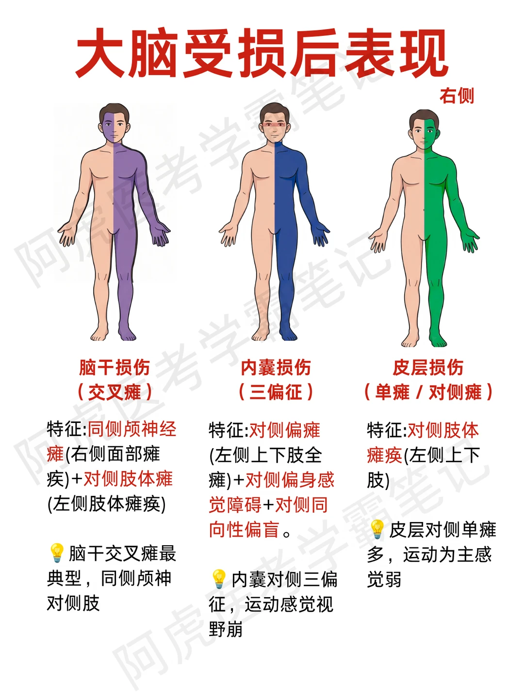 阿虎医考笔记📒大脑不同部位受损表现❤️