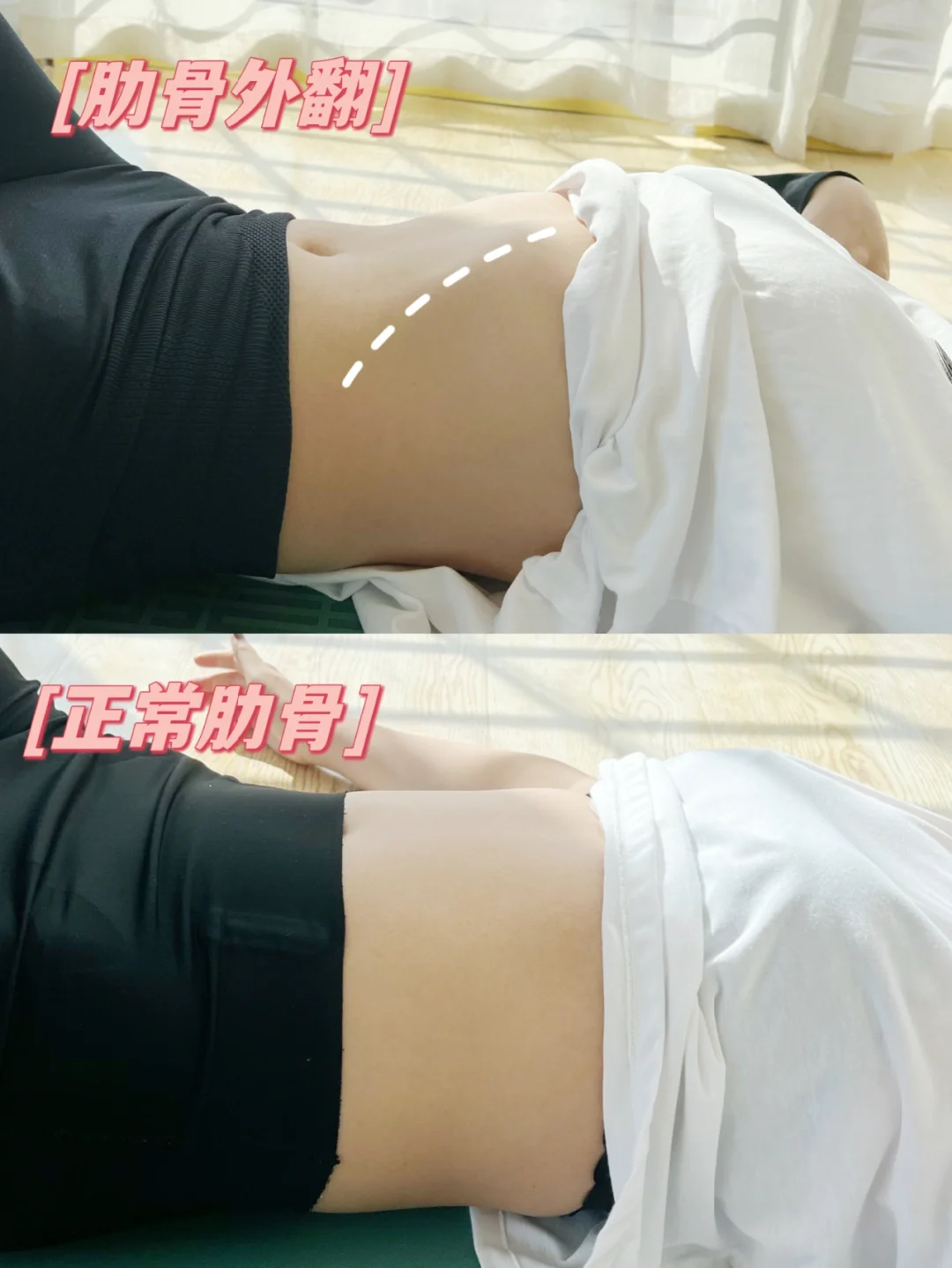 绝了！4个动作改善肋骨外翻！真有用！