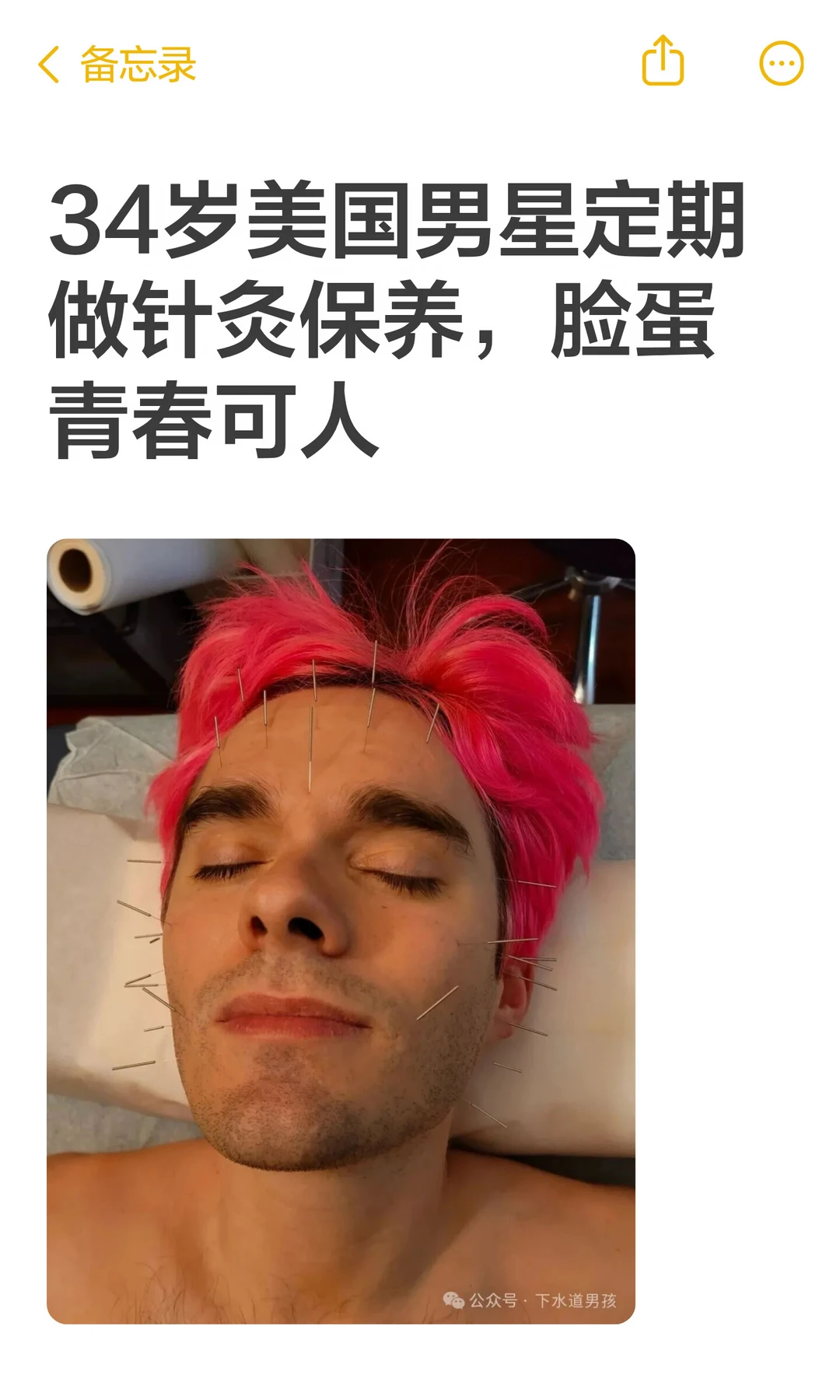 34岁美国男星定期做针灸保养，脸蛋青春可人