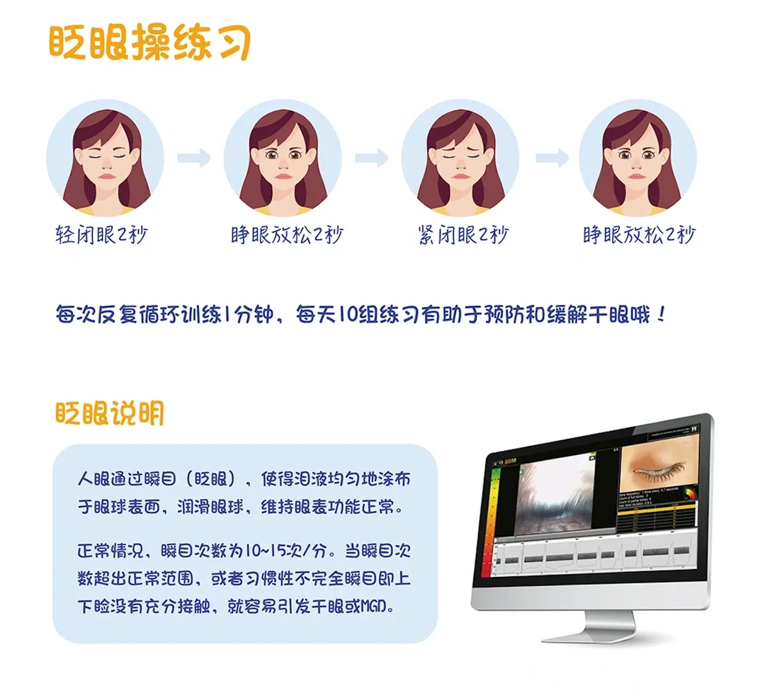 干眼人群可以做的眨眼练习