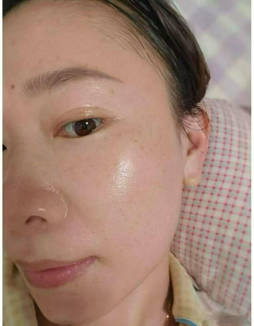 💕立秋之后皮肤急需以油养肤☁️精华油就选：张柏芝同款爱用精华油🔥#麦吉丽焕颜精华油 
👀看顾客用完最真实的皮肤改善‼️肤质更细腻，暗沉干燥一扫而光，真实效果就是硬实力👍 ​