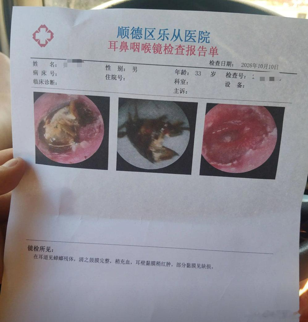 #广东男子睡梦中遭蟑螂钻耳道# 曾经担心过，没想到真有那么一天[允悲][允悲] 
蟑螂：本来只想借宿，结果直接长眠。 ​