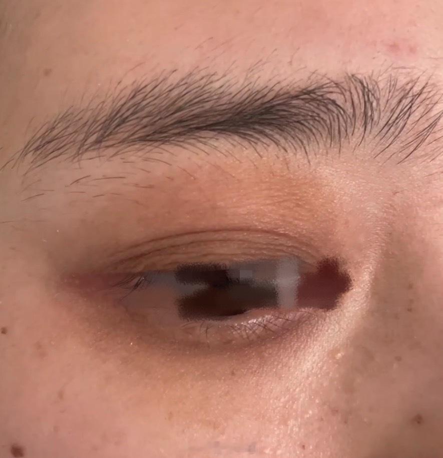 眼周围发青黑的人，单身的感情很容易纠缠不清，平时想法消极、忧郁，气血不畅，肾气亏少熬夜。 ​​​