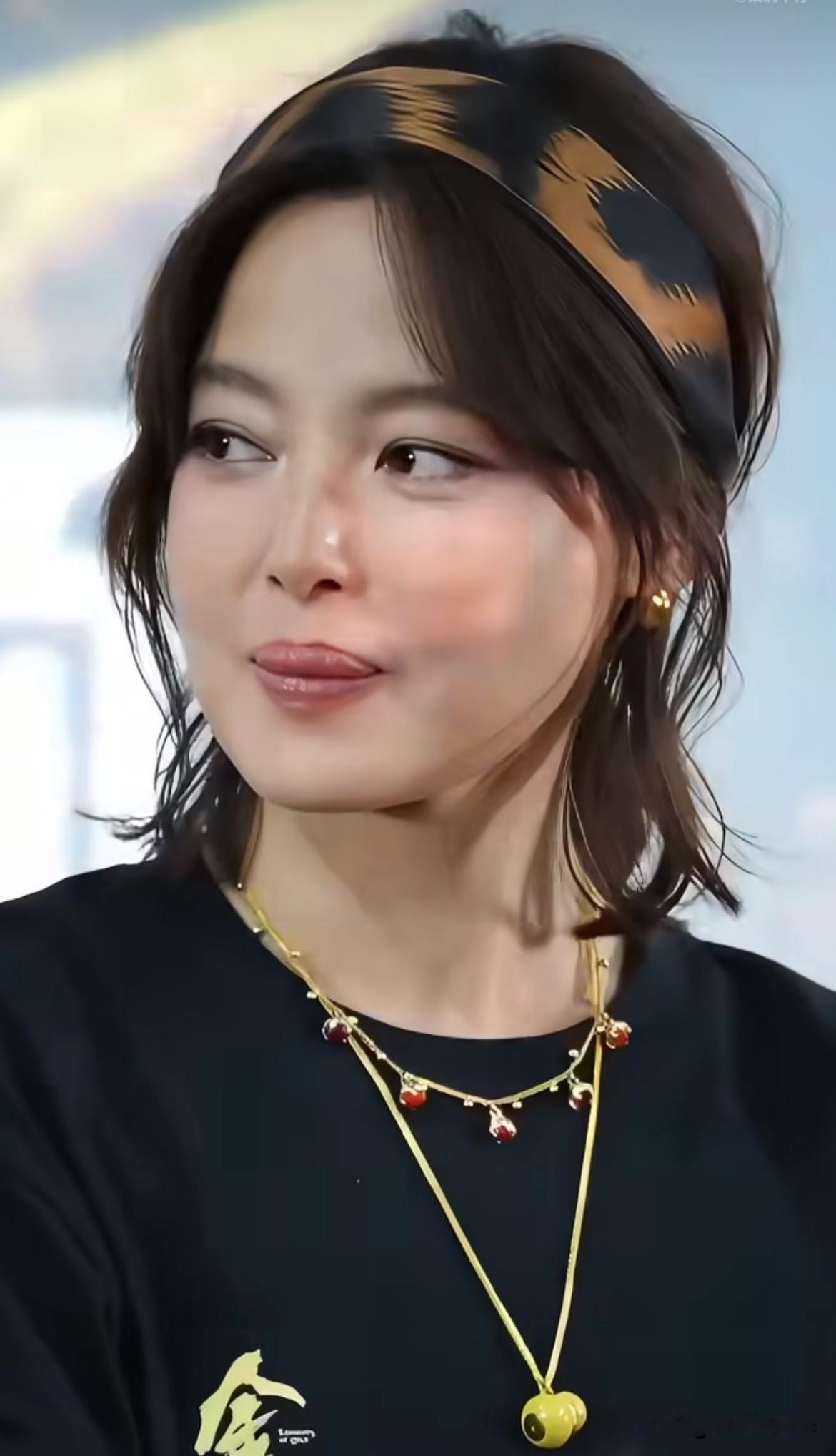 辛芷蕾如今上唇外翻问题愈发突出，镜头里观感格外扎眼，乍一看甚至像舌头一直抵着嘴唇。对比刚出道时期唇形差距极大，很难不让人怀疑是多次丰唇留下的后遗症。过度调整反而破坏原生五官比例，演戏时观众视线很容易被异样的嘴唇牢牢抓住，根本没法沉浸剧情，严重拖垮表演观感。辛芷蕾
