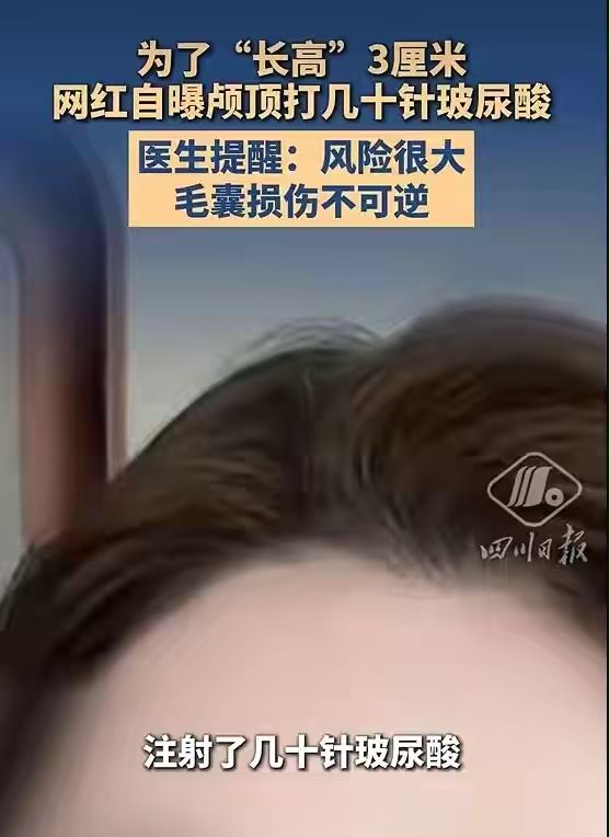 网红梅尼耶的妻子分享医美经历，颅顶注射几十针玻尿酸，实现视觉上三厘米的增高效果。
谁能料到，追求头脸比例的精致，会有人选择这样的方式。这条分享一经放出，迅速在爱美人群里面传开。不少人盯着这个三厘米的变化跃跃欲试。专业医生及时发声敲醒警钟。所谓长高，只是表象。
玻尿酸填充改变皮下软组织厚度，颅骨骨骼不