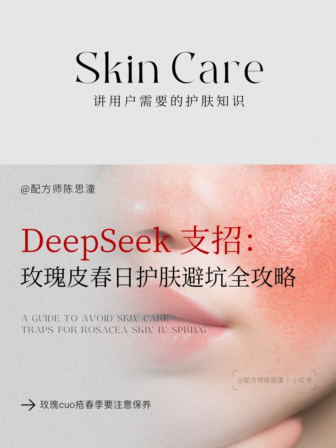 护肤知识｜当我问Deepseek春敏玫瑰皮怎么办
