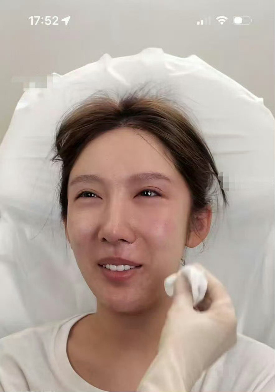 #都美竹 医美#
我觉得长成这样做什么医美豆没有用了啊🙊 ​