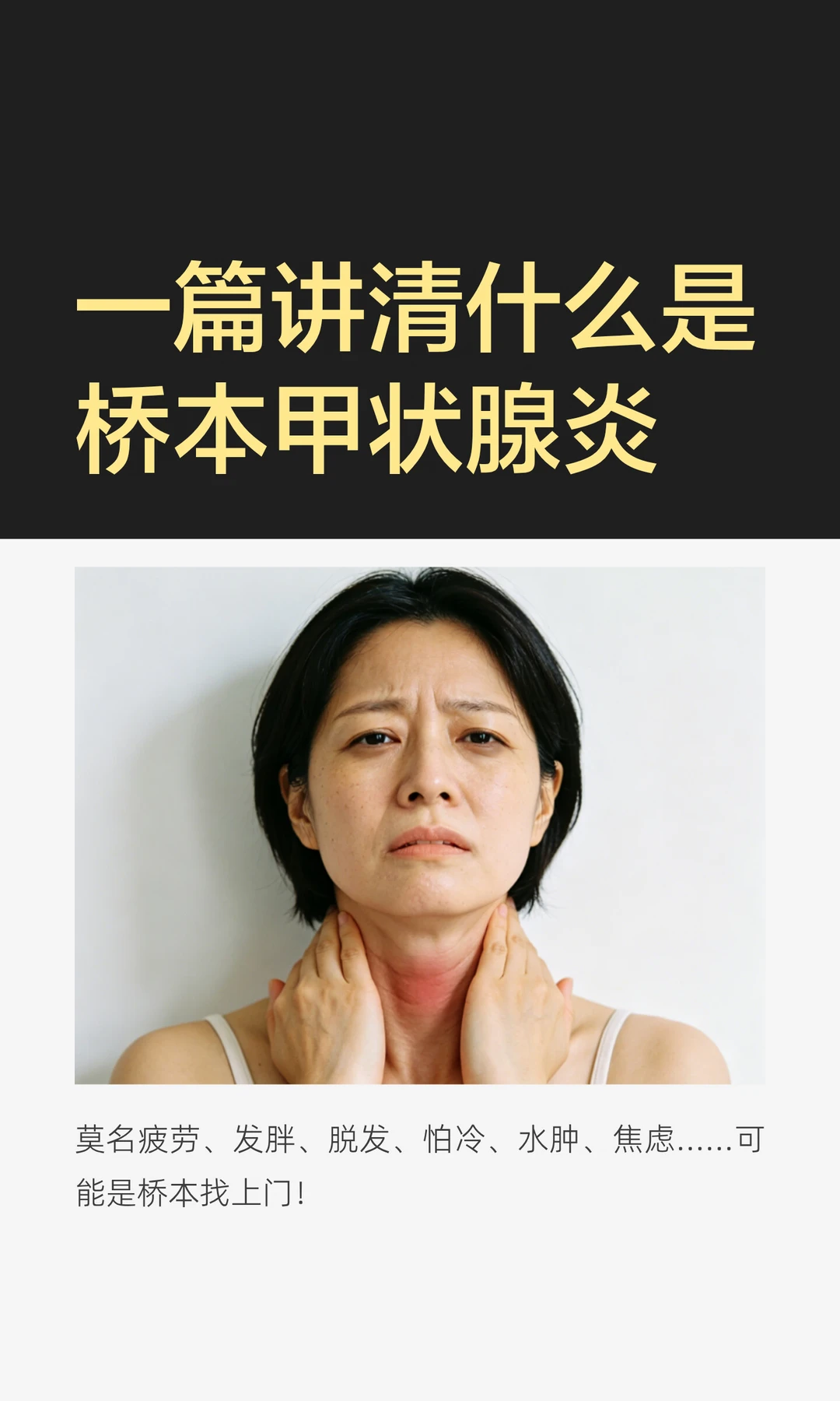 一篇讲透桥本甲状腺炎|疲劳发胖脱发水肿