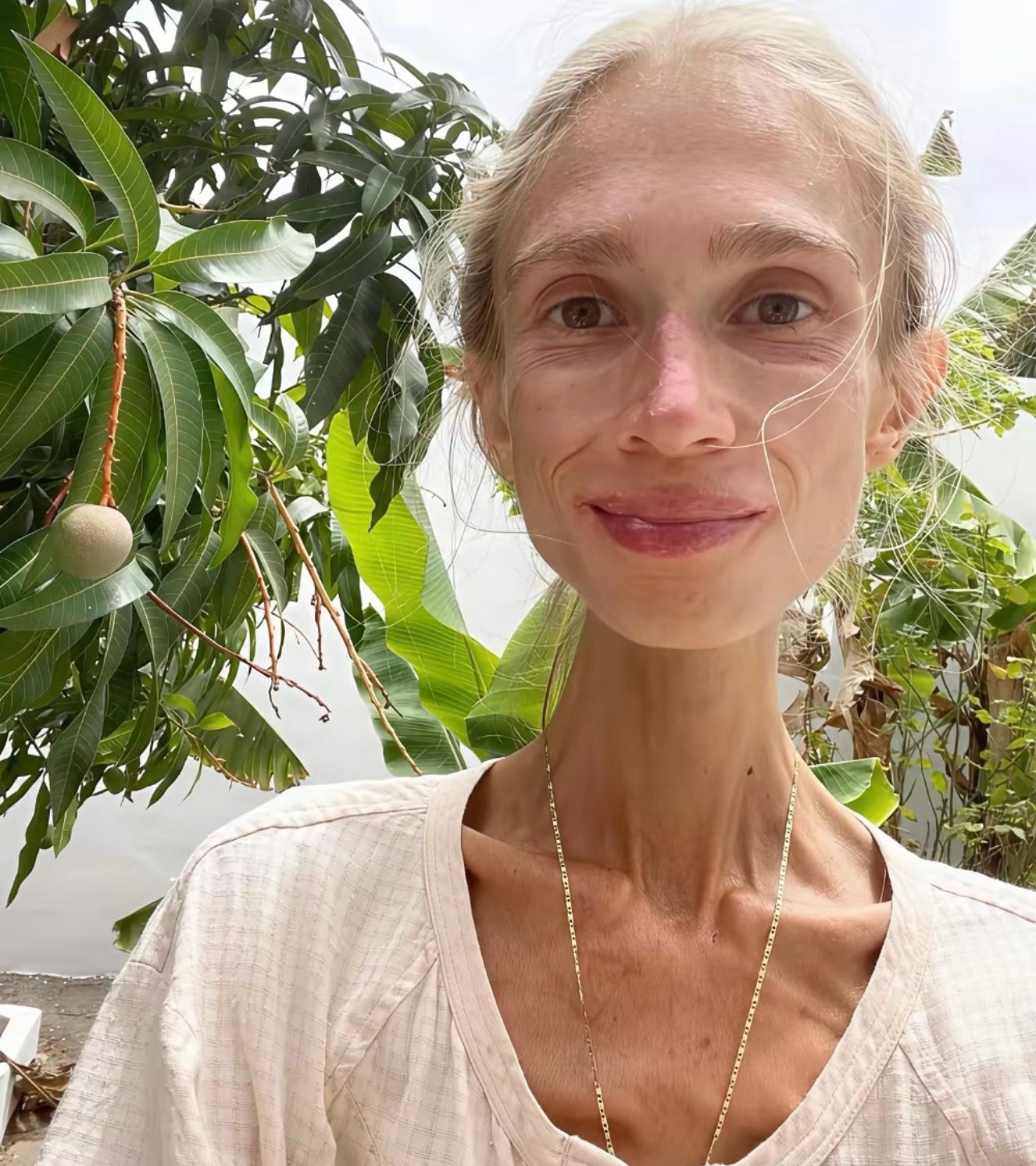 吃得越狠老得越慢省流总结就是减少一点摄入不要每一顿都吃特别饱但是我很反对极端节食、这不是胖瘦问题是吃的太少营养不足的问题、所以我一直口服补剂，就是因为我总吃外卖+挑食图里这个波兰网红，就吃得很极端，一直倡导接近自然，导致长期营养不良，肌肉和器官在长期自我消耗里，慢慢衰竭了、最后死在酒店里。我个人的建议是，不要为了减肥不吃肉蛋奶，蛋白质真的非常非常重要，尤其是肌肉很需要这个，苍白无力的瘦不仅仅是没劲儿，还有可能脸色不好，掉头发，皮肤发黄没弹性、缺乏生命力，也不美哈。