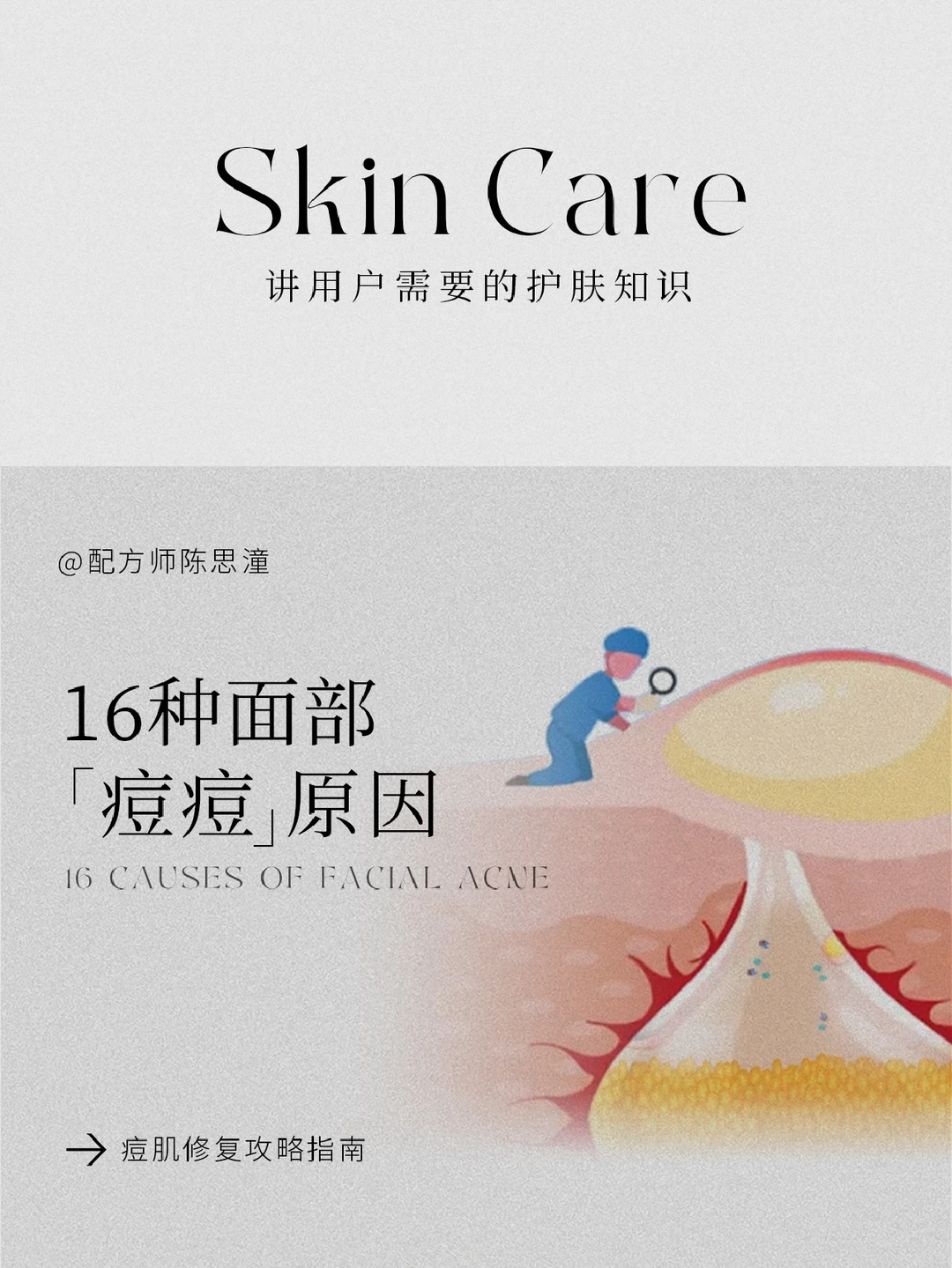 护肤知识｜16种面部「痘痘」原因➕祛痘指南
