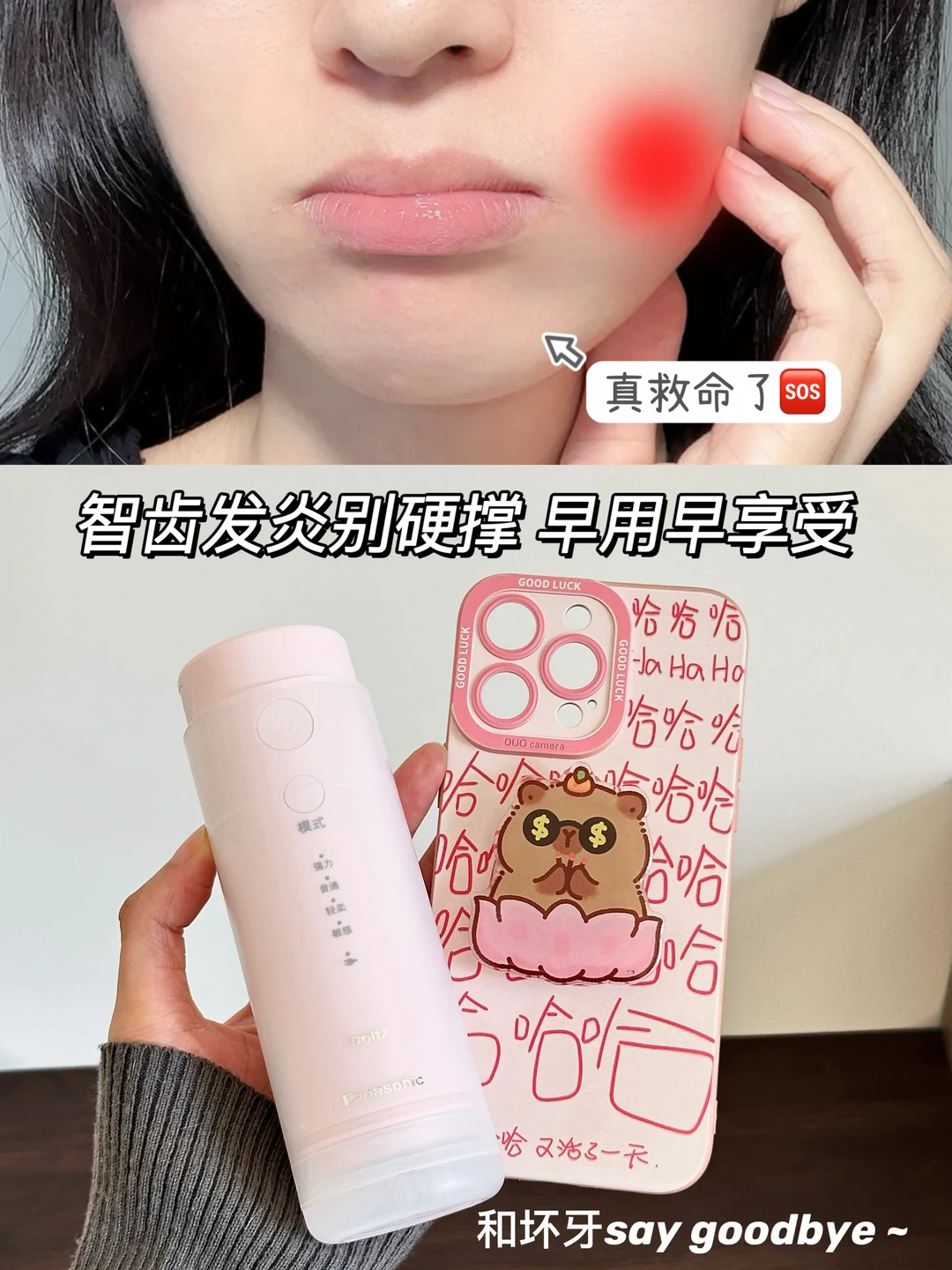 救命🆘智齿发炎别硬撑！这个冲牙器救了大命！