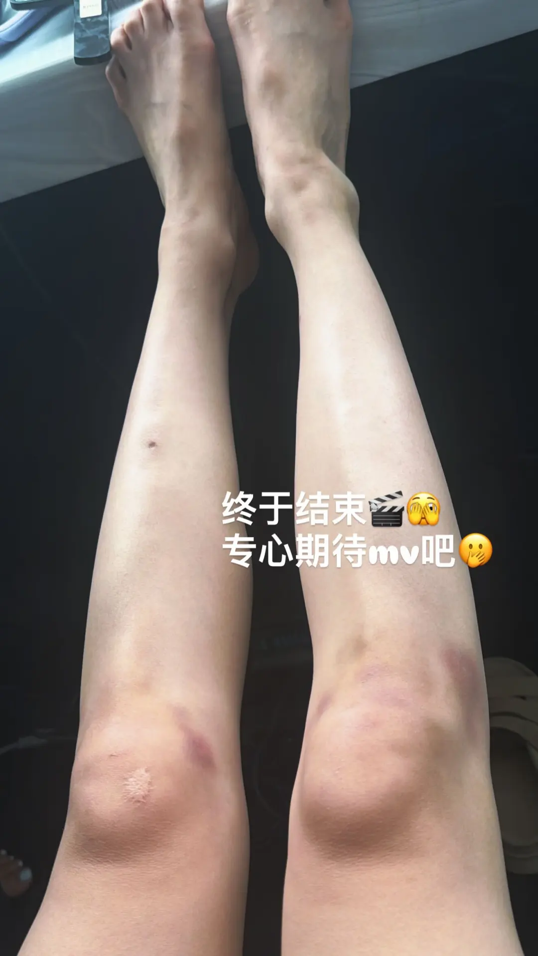 这MV是有打戏啊，怎么伤痕累累的
