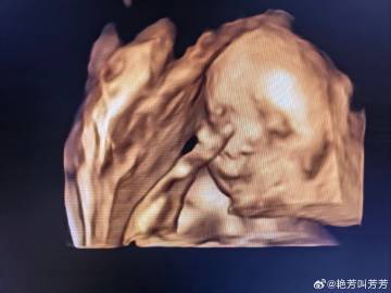 做了三次才勉强通过，不是趴着就是把手手放脸上不让看，别人的四维照片可可...