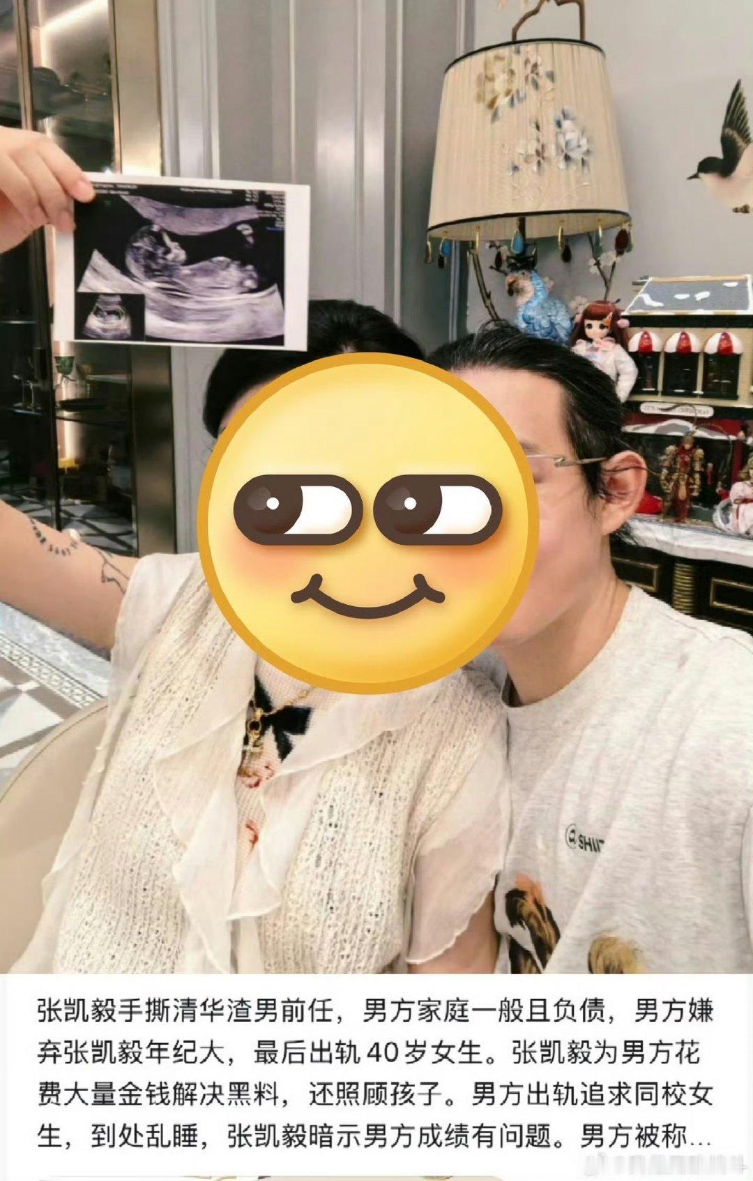 #张凯毅前夫被曝称当网红像耍猴#他俩当时结婚轰轰烈烈，她前夫觉得被当猴就别当网红，赚了那么多钱现在说这些 ​